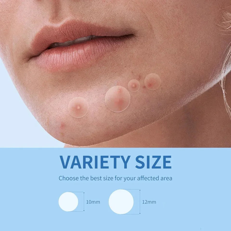 Invisible Acne Healing Patches